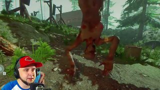 THE MASSACRE | The Forest | Madd Adventures 8