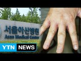 [단독] 대형병원 세탁실 직원들 '옴' 감염...원인 파악 못해 / YTN (Yes! Top News)