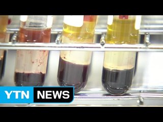 불안불안 C형 간염...모든 감염자 신고 의무화 전환 / YTN (Yes! Top News)