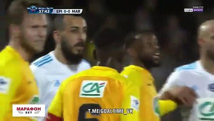 Buts Epinal 0-2 Marseille (OM) Résumé de match - 23.01.2018