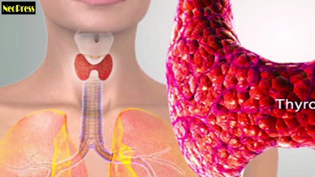 Thyroid: Symptoms & Natural Remedies!