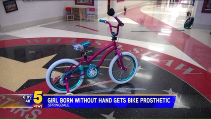 Girl Born with One Hand Gets Bike Prosthetic to Make Riding Easier