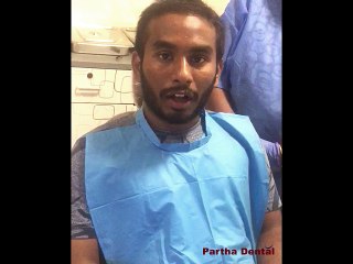 Latest treatment for Tooth correction with a orthodontic retainer at partha dental,