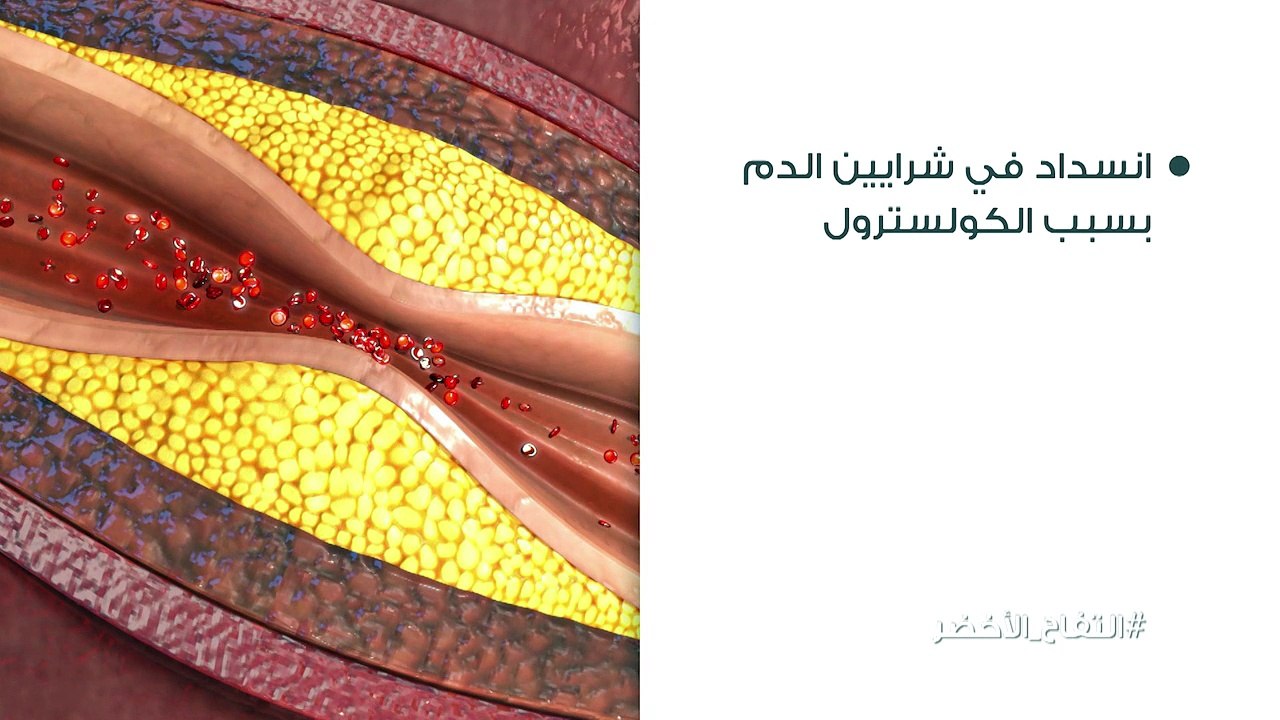 ‏ما هي خصائص تخطيط القلب، وما هي المشاكل الصحية التي يمكنك إكتشافها!
