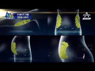 [예고] 미병(未炳)의 근원,만성 염증을 잡아라