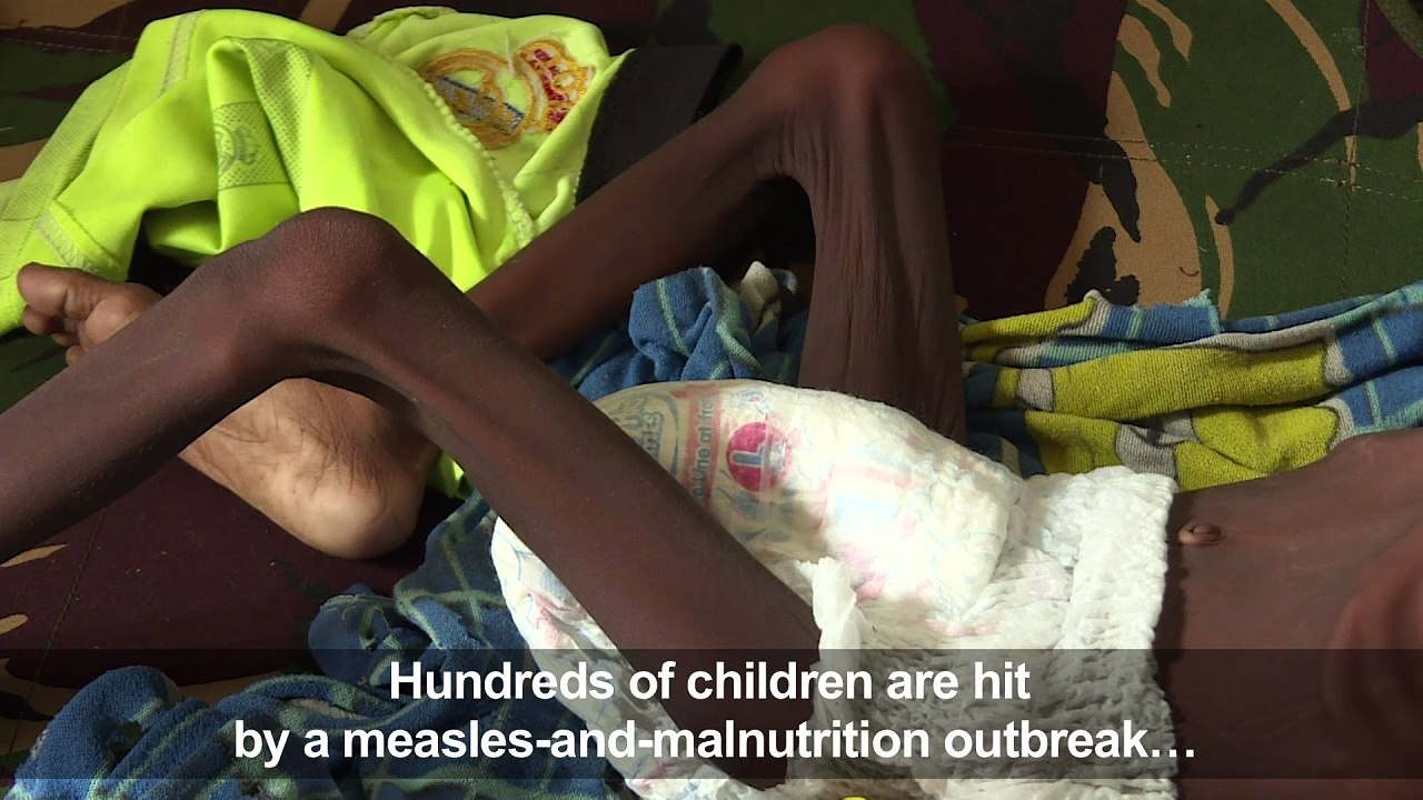 Hundreds of children sickened, dead in Papua health crisis