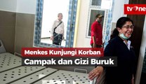 Menkes Kunjungi Korban Gizi Buruk dan Campak