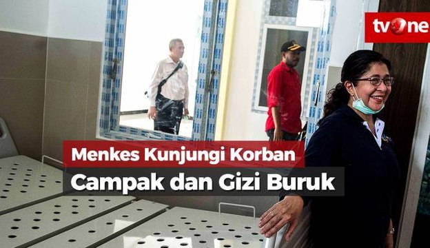 Menkes Kunjungi Korban Gizi Buruk dan Campak