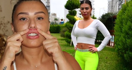 Sahte Estetikçi Mağduru Genç Kadın, Şimdi de Güzellik İçin Kaburga Kemiğini Aldıracak