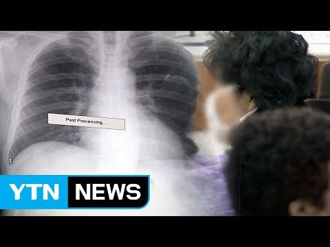 호흡기 질환 사망률 증가... 대기 오염 악화 탓 / YTN