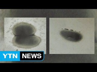간·신장 독성유발 물질 '피렌' 잡는 세균 2종 발견 / YTN