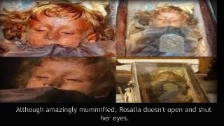 Is Child mummy Rosalia Lombardo Opening Her Eyes?