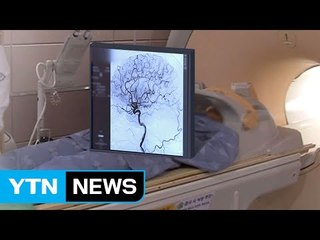 뇌경색 골든 타임 '3시간'...50대 이상은 각별히 주의! / YTN