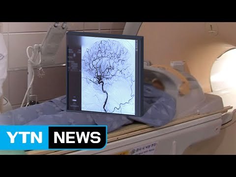 뇌경색 골든 타임 '3시간'...50대 이상은 각별히 주의! / YTN