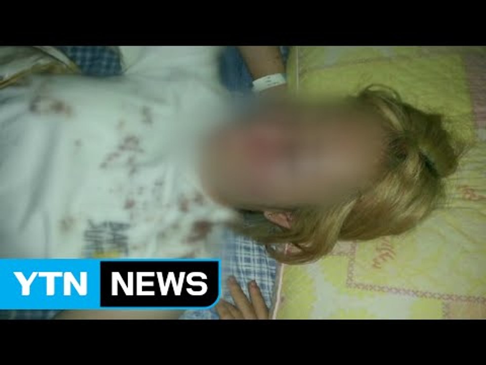 [단독] 또 '묻지 마 폭행'...경찰은 가해자 석방 / YTN