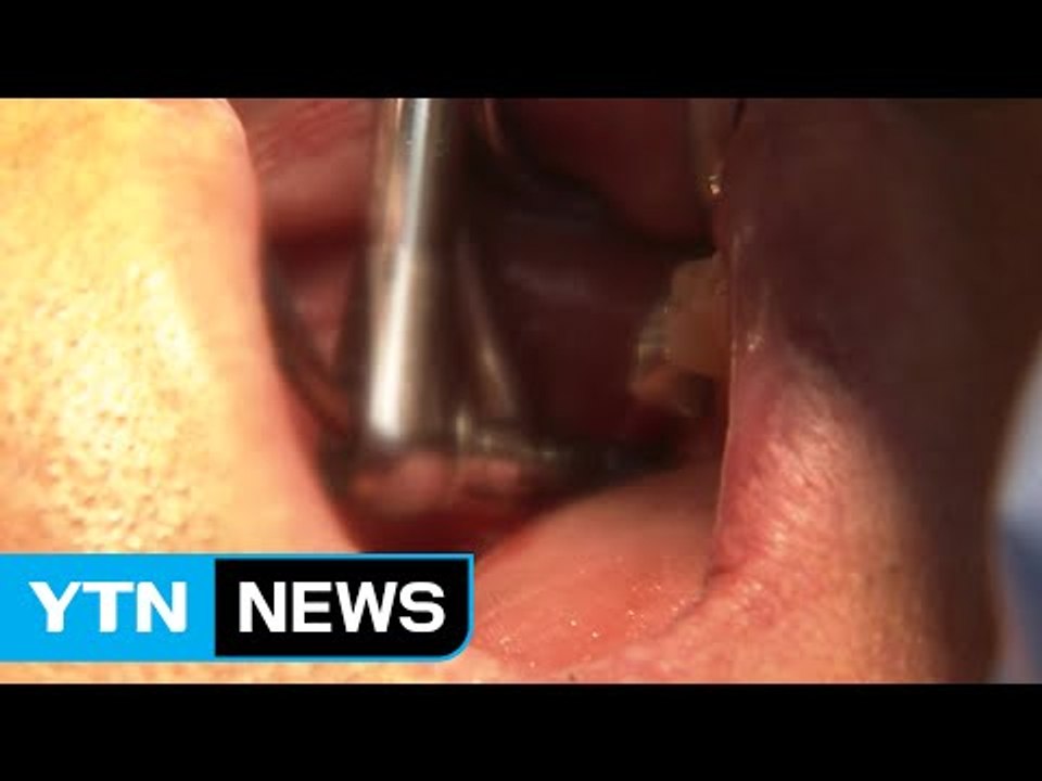 "임플란트 부작용 속출…40%는 시술 중단" / YTN (Yes! Top News)