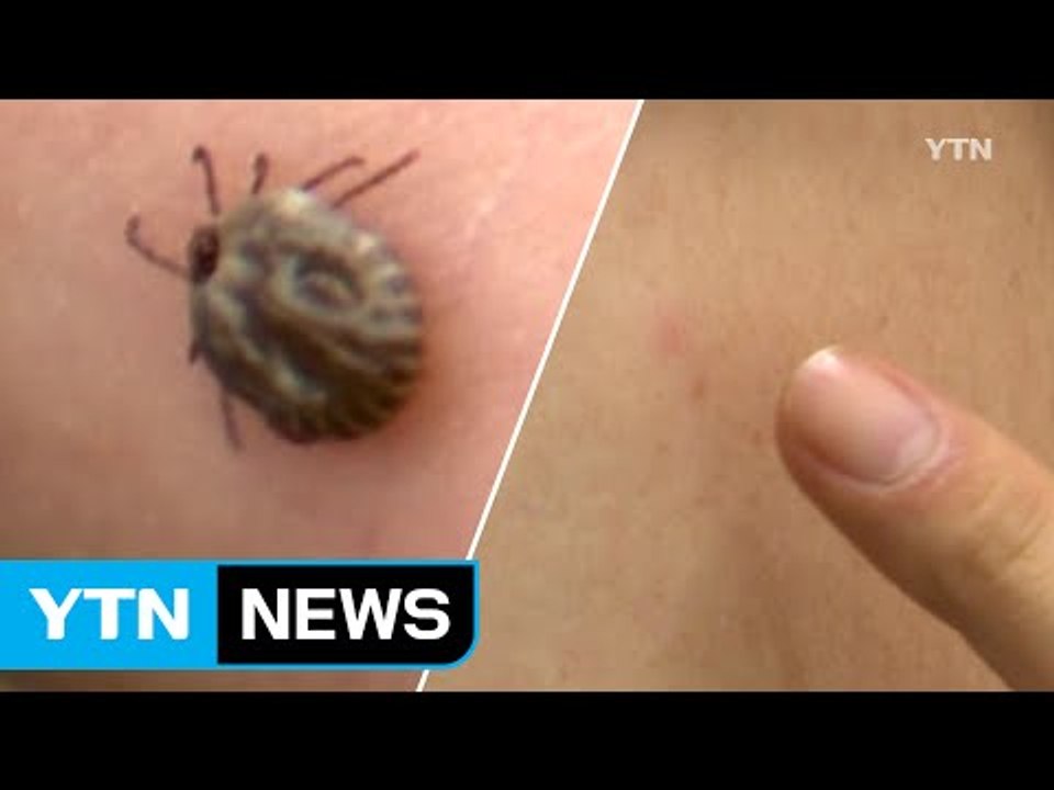 '봄나들이 불청객' 감염병 진드기 조심하세요! / YTN (Yes! Top News)