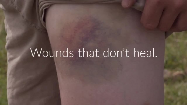 7 Diabetes Symptoms You Shouldn't Ignore