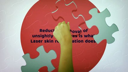 Laser Skin Rejuvenation - Senna Forever