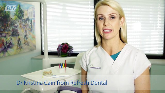 Caring for your Implants