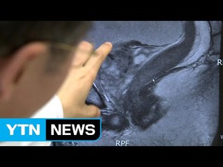 남성 위암 1위는 충북 보은·간암 1위는 경북 울릉 / YTN (Yes! Top News)