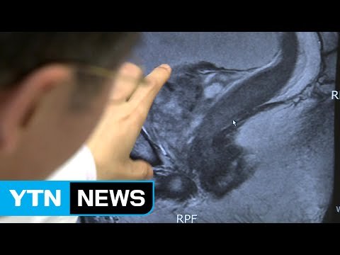 남성 위암 1위는 충북 보은·간암 1위는 경북 울릉 / YTN (Yes! Top News)