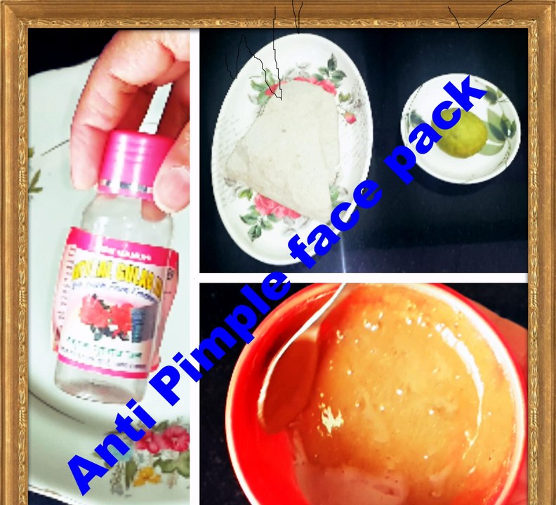 How To Remove Pimples Fast  Get Ride Of Pimple and Acne in One Day