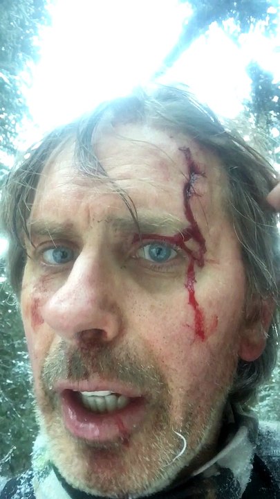 Yukon Man Gored by Bison