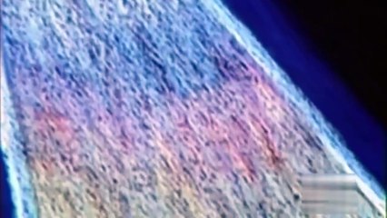 Zeta Reticuli : Grey Alien Abduction Cases