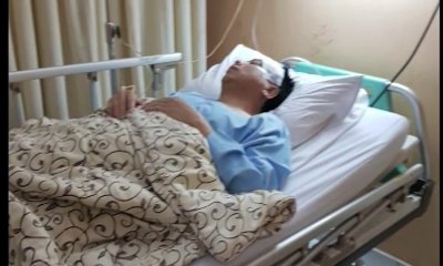 Cerita Saksi Mata soal Kecelakaan Setya Novanto