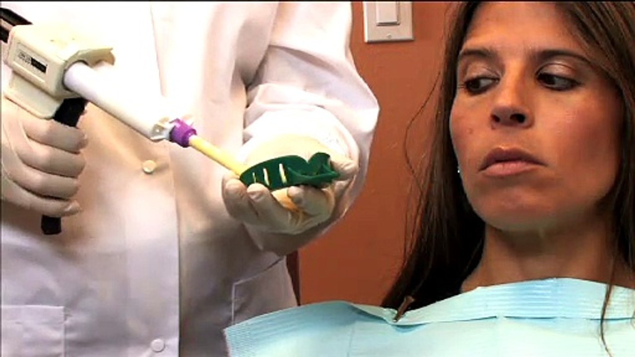 Home Teeth Whitening