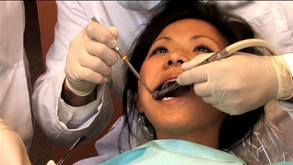 Porcelain on Metal Crowns