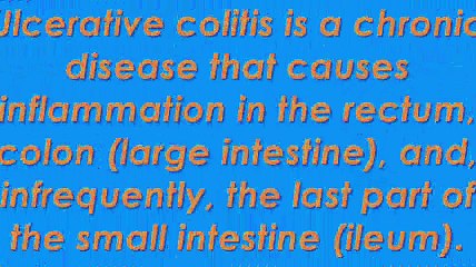 Ulcerative Colitis