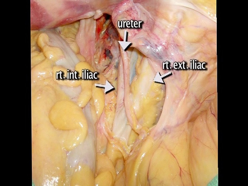 Anatomty of Ureter