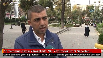 15 Temmuz Gazisi Yılmaztürk: "Bu Yüzümdeki İz O Geceden Kalma Bir Şeref Nişanesidir"
