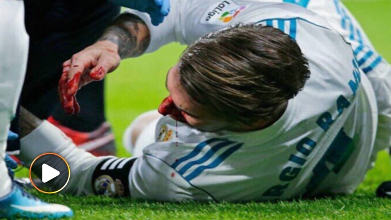 Kapten Real Madrid patah hidung