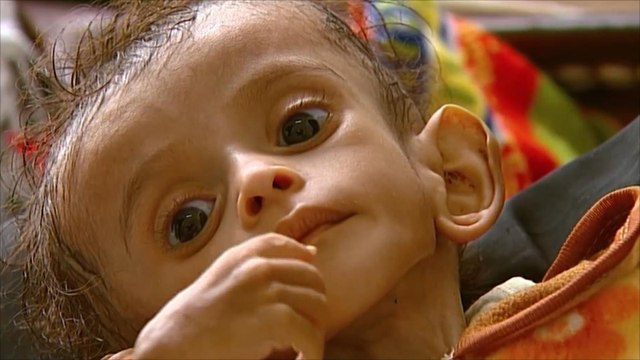 منظمة حقوقية: 716 انتهاكا باليمن خلال شهر واحد