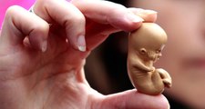 Test Yok, Ultrasonlar Hileli! Hamile Olmayan Kadınlara Kürtaj Yapıyorlar
