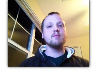 Nystagmus Explained: Causes, Physiology, and How It Affects You 👁️