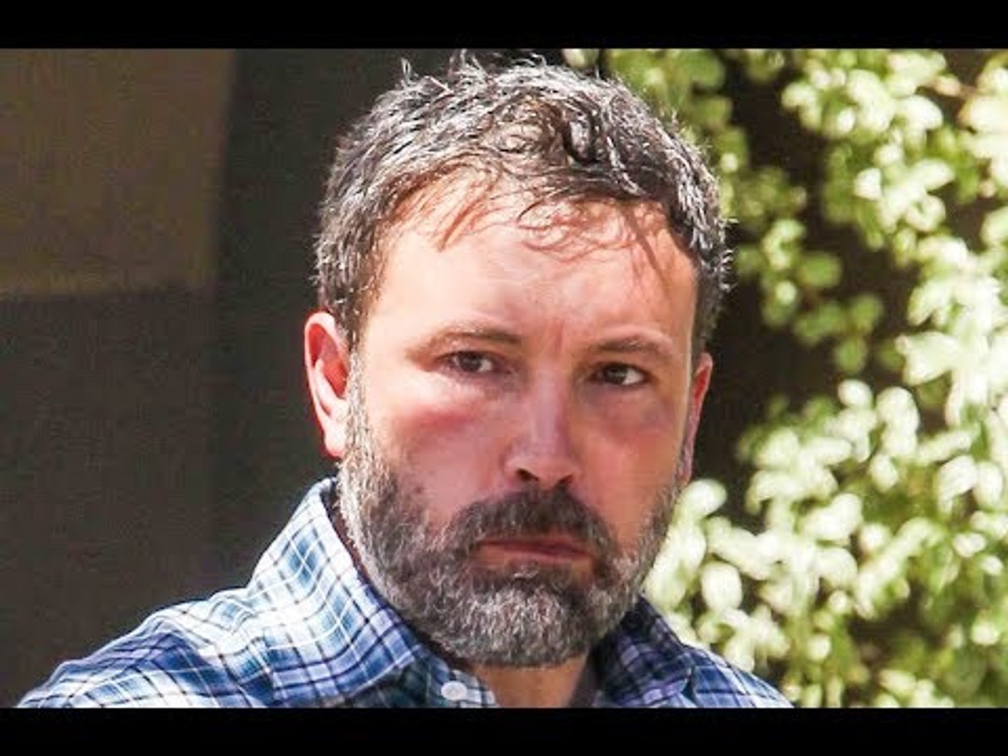 ⁣Heartbroken Ben Affleck: Wrinkled & Lonely After Scandalous Split