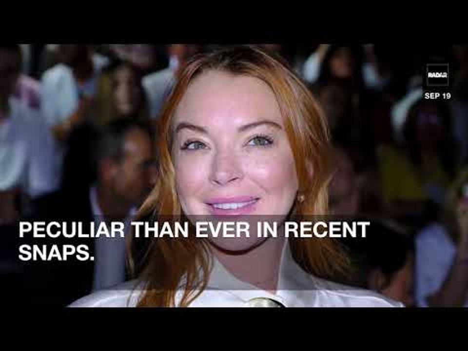 Lindsay Lohan Shocks Fans With Unrecognizable Filler-Filled Face!