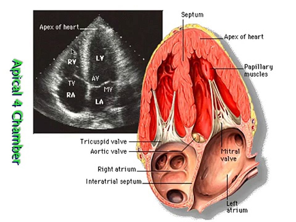 AIMMS LIBRARY Rapid-Ultrasound-in-SHock VIDEO 21