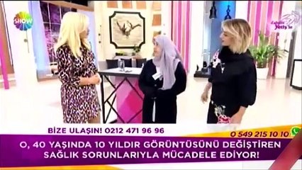 Zahide Yetiş'in programına katılan sakallı kadını görenler şaştı kaldı