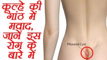 Pilonidal Cyst: कूल्हे की गांठ में मवाद, जानें इस बीमारी के बारे में | Lump in hip joint | Boldsky