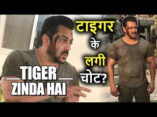 Tiger Zinda Hai की Shooting में Salman Khan हुए Injured, Viral हुई Picture