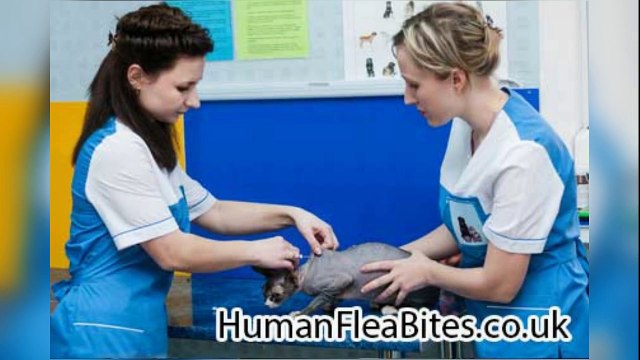 UK - Flea Bites on Humans Get Rid of Fleas Pest Control, Fumigate