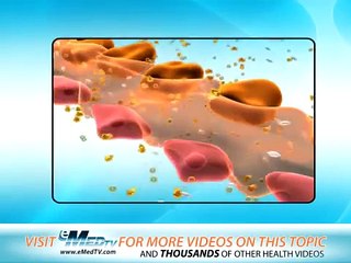 Diabetes Symptoms- Medical Videos