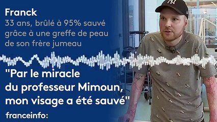Franck :"Par le miracle du professeur Mimoun, mon visage a été sauvé"