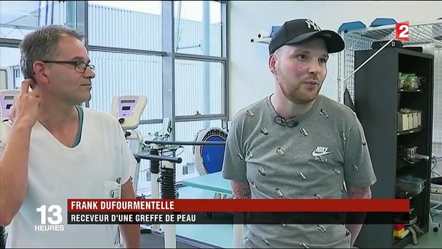 Greffe : un grand brûlé sauvé par la peau de son frère jumeau