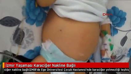 İzmir Yaşaması Karaciğer Nakline Bağlı